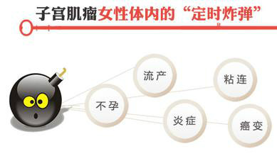 运城做子宫肌瘤手术的费用