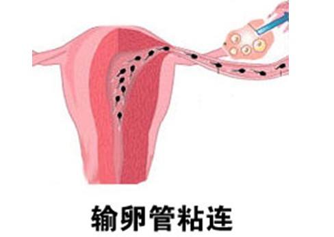 运城妇科医院