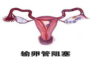 运城妇科医院